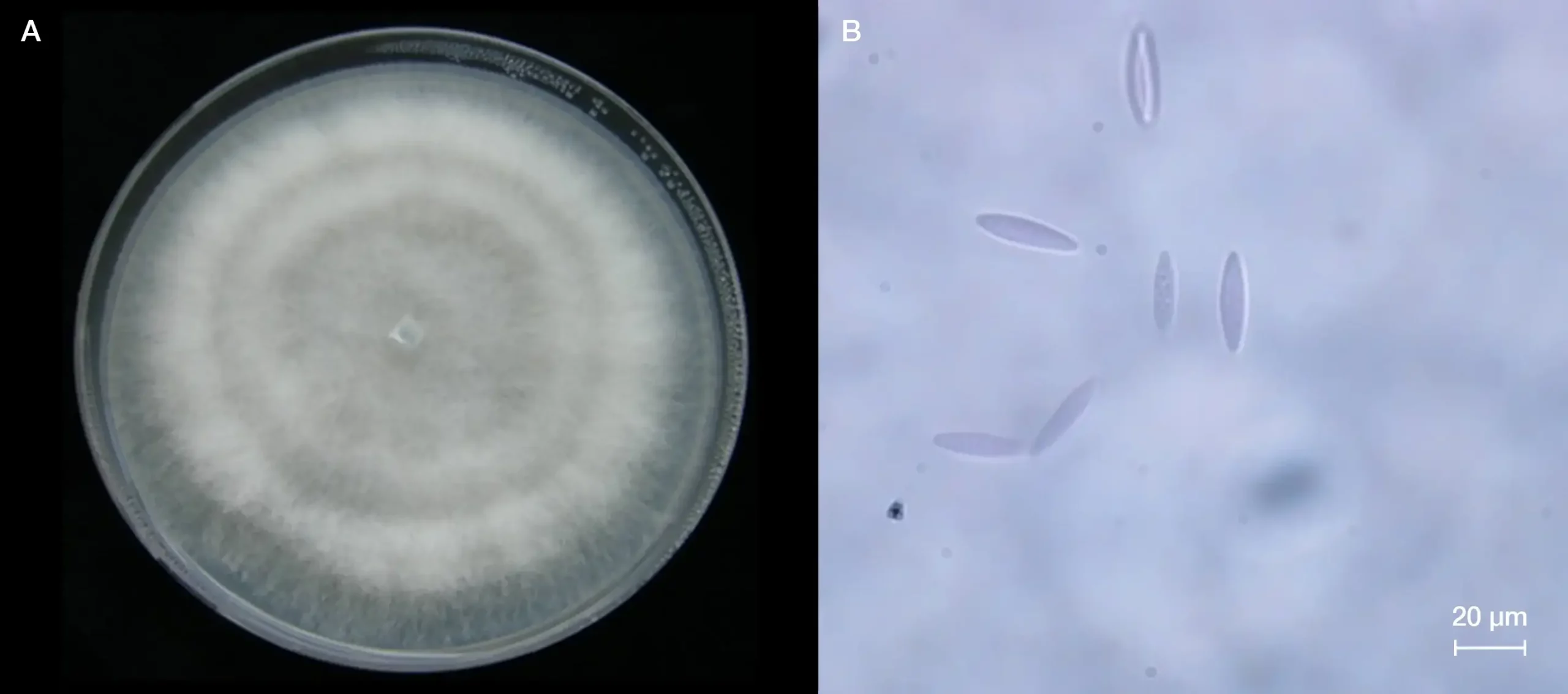 Figura 7. A) Colonia de Neofusicoccum mediterraneum desarrollada en medio de cultivo patata dextrosa agar (PDA) durante 7 días en oscuridad; B) conidios típicos de N. mediterraneum observados mediante miscroscopio óptico.